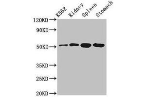 Western Blot Positive WB detected in: K562 whole cell lysate, Rat kidney tissue, Rat spleen tissue, Mouse stomach tissue All lanes: ALDH3B1 antibody at 3 μg/mL Secondary Goat polyclonal to rabbit IgG at 1/50000 dilution Predicted band size: 52, 48 kDa Observed band size: 52 kDa (ALDH3B1 anticorps  (AA 168-449))