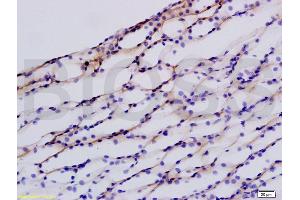 Formalin-fixed and paraffin embedded rat kidney labeled with Anti-beta Defensin 1 Polyclonal Antibody, Unconjugated (ABIN738591) at 1:200 followed by conjugation to the secondary antibody and DAB staining.