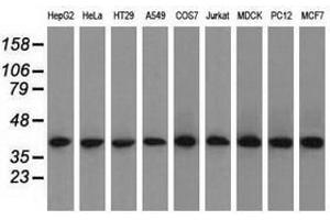 Image no. 8 for anti-Acetyl-CoA Acetyltransferase 2 (ACAT2) antibody (ABIN1496400) (ACAT2 anticorps)