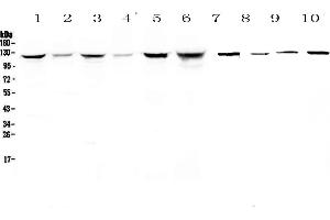 Western blot analysis of IDE using anti-IDE antibody . (IDE anticorps  (AA 485-756))