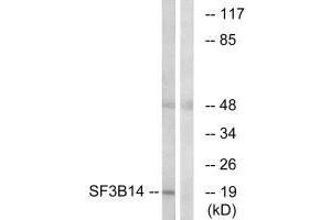 Western blot analysis of extracts from HepG2 cells, using SF3B14 antibody. (Pre-mRNA Branch Site Protein p14 (SF3B14) (C-Term) anticorps)