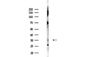 anti-Kelch Domain Containing 8A (KLHDC8A) antibody