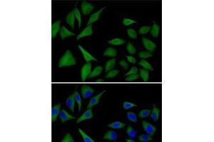 Immunofluorescence analysis of MCF7 cells using ATOX1 Polyclonal Antibody (ATOX1 anticorps)
