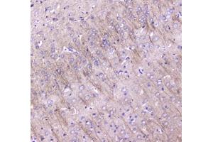 IHC testing of FFPE rat brain tissue with LC3A antibody at 1ug/ml. (MAP1LC3A anticorps)