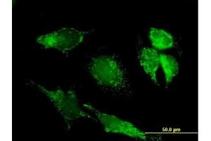Immunofluorescence of purified MaxPab antibody to PDHX on HeLa cell. (PDHX anticorps  (AA 1-501))