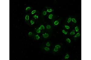 Immunofluorescence staining of Hela cells (treated with 30mM sodium butyrate for 4h) with ABIN7139147 at 1:2.