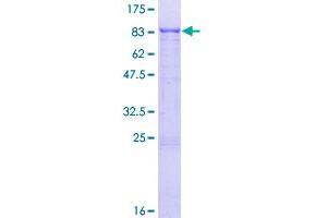 Image no. 1 for Zinc Finger Protein 192 (ZNF192) (AA 1-578) protein (GST tag) (ABIN1325953)