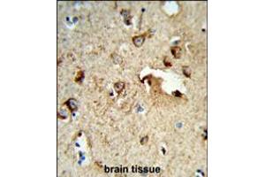 Formalin-fixed and paraffin-embedded human brain tissue reacted with TSPAN1 Antibody , which was peroxidase-conjugated to the secondary antibody, followed by DAB staining.