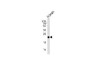 Western blot analysis of lysate from human brain tissue lysate, using CPLX3 Antibody (Center) (ABIN654609 and ABIN2844309).