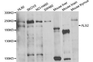 Western blot analysis of extracts of various cell lines, using ALS2 antibody. (ALS2 anticorps)