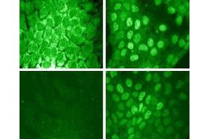 Immunofluorescence staining for Stat1 (pY701) (middle left figure).