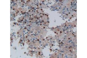 Used in DAB staining on fromalin fixed paraffin- embedded lung cancer tissue (LGALS13 anticorps  (AA 1-139))