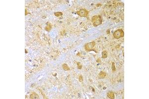 Immunohistochemistry of paraffin-embedded mouse brain using SPAG16 antibody at dilution of 1:100 (x400 lens). (SPAG16 anticorps)