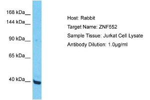 Host: Rabbit Target Name: ZNF552 Sample Type: Jurkat Whole Cell lysates Antibody Dilution: 1. (ZNF552 anticorps  (Middle Region))