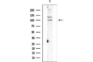 anti-TEL2, Telomere Maintenance 2, Homolog (TELO2) (Internal Region) antibody