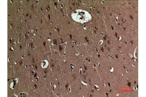 Immunohistochemistry (IHC) analysis of paraffin-embedded Human Brain, antibody was diluted at 1:100. (BNIP3 anticorps  (Internal Region))