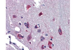 Anti-NR2E1 antibody IHC of human brain, cortex.