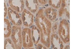 Immunohistochemical staining of formalin-fixed paraffin-embedded human fetal kidney tissue showing cytoplasmic and nuclear staining with PDCD5 polyclonal antibody  at 1 : 100 dilution. (PDCD5 anticorps  (N-Term))