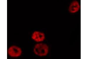 ABIN6269173 staining HepG2 by IF/ICC.