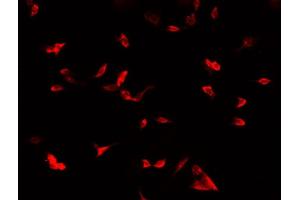 ABIN6269013 staining MCF-7 cells by IF/ICC. (COX IV anticorps  (Internal Region))