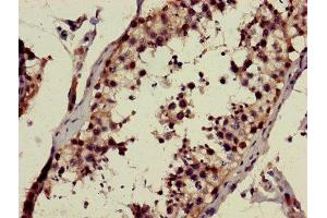 Immunohistochemistry of paraffin-embedded human testis tissue using ABIN7146692 at dilution of 1:100 (CHST9 anticorps  (AA 33-129))