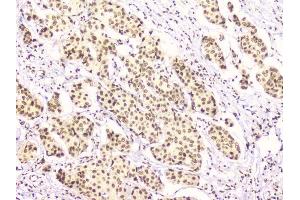 IHC analysis of RbAp48 using anti-RbAp48 antibody (ABIN5692929). (Retinoblastoma Binding Protein 4 anticorps  (C-Term))