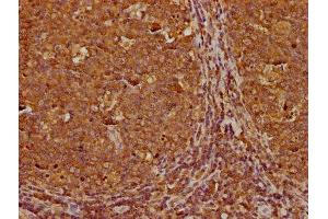 IHC image of ABIN7166965 diluted at 1:300 and staining in paraffin-embedded human tonsil tissue performed on a Leica BondTM system. (RABEP1 anticorps  (AA 1-255))