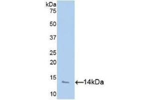 WB of Protein Standard: different control antibodies against Highly purified E. (PF4 Kit CLIA)