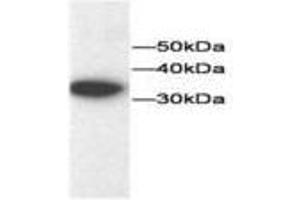 Image no. 1 for anti-Thioredoxin (TXN) antibody (ABIN791544) (TXN anticorps)