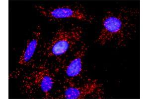Proximity Ligation Analysis of protein-protein interactions between NUMB and APP.