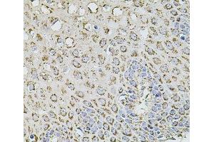 Immunohistochemistry of paraffin-embedded Human esophagus using TMC1 Polyclonal Antibody at dilution of 1:100 (40x lens). (TMC1 anticorps)