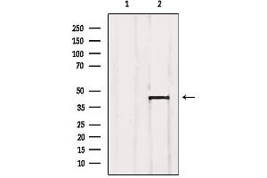 Western blot analysis of extracts from SP2/0, using Aurora Kinase Antibody. (Aurora A anticorps  (Internal Region))