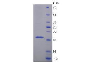 Image no. 1 for Mucin 5 Subtype B (MUC5B) (AA 6489-6632) protein (His tag) (ABIN4988493) (MUC5B Protein (AA 6489-6632) (His tag))
