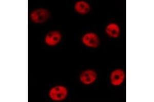 ABIN6267400 staining HeLa by IF/ICC. (CREB1 anticorps  (pSer133))