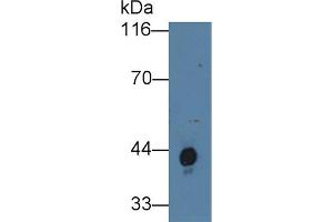 Detection of Hpt in Human Serum using Polyclonal Antibody to Haptoglobin (Hpt) (Haptoglobin anticorps  (AA 44-157))