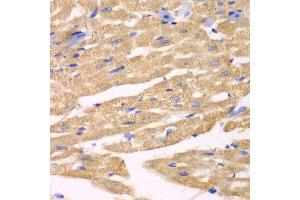Immunohistochemistry of paraffin-embedded mouse heart using APLP1 antibody at dilution of 1:100 (x40 lens).