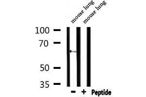 Western blot analysis of extracts from mouse lung, using CEACAM20 Antibody. (CEACAM20 anticorps  (Internal Region))