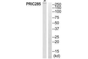 Western blot analysis of extracts from Jurkat cells, using PRIC285 antibody. (HELZ2 anticorps)