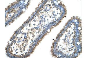 Immunohistochemistry (IHC) image for anti-Carbamoyl-Phosphate Synthase 1, Mitochondrial (CPS1) (Middle Region) antibody (ABIN2782319)