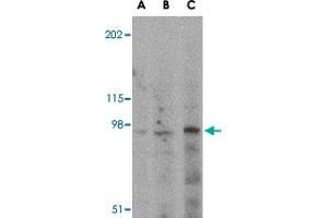 Western blot analysis of GRIK5 in human brain tissue lysate with GRIK5 polyclonal antibody  at (A) 0.