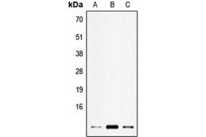 Western blot analysis of ELOF1 expression in HEK293T (A), SP2/0 (B), H9C2 (C) whole cell lysates. (ELOF1 anticorps  (Center))