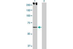 Western Blot analysis of CDH6 expression in transfected 293T cell line by CDH6 MaxPab polyclonal antibody. (CDH6 anticorps  (AA 1-663))
