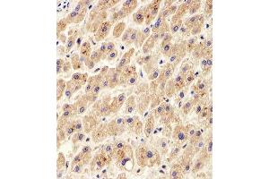 Immunohistochemical analysis of paraffin-embedded H. (PDIA6 anticorps  (AA 144-172))
