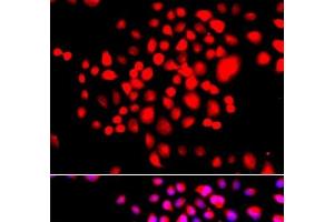 Immunofluorescence analysis of A549 cells using STK19 Polyclonal Antibody (STK19 anticorps)