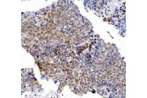 IHC analysis of CHCHD10 using anti-CHCHD10 antibody (ABIN7602507). (CHCHD10 anticorps  (AA 80-142))