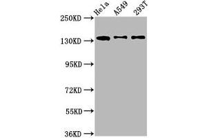Western Blot Positive WB detected in: Hela whole cell lysate, A549 whole cell lysate, 293T whole cell lysate All lanes: MAN2B2 antibody at 1.