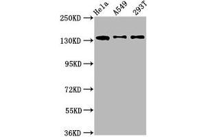 Western Blot Positive WB detected in: Hela whole cell lysate, A549 whole cell lysate, 293T whole cell lysate All lanes: MAN2B2 antibody at 1. (MAN2B2 anticorps  (AA 347-523))