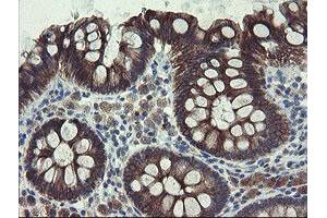 Image no. 15 for anti-Diphthamide Biosynthesis Protein 2 (DPH2) antibody (ABIN1497891)