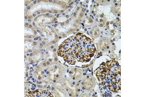 Immunohistochemistry of paraffin-embedded rat kidney using CETP antibody (ABIN5970634) (40x lens). (CETP anticorps)