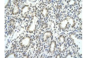 Rabbit Anti-TEAD1 antibody Catalog Number: ARP39521  Paraffin Embedded Tissue: Human Lung  cell Cellular Data: alveolar cell  Antibody Concentration: 4.
